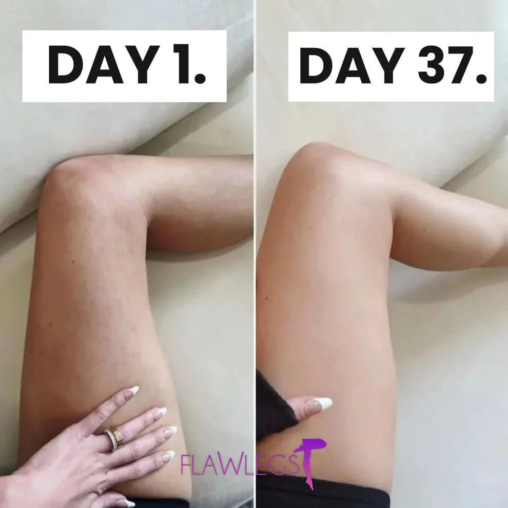 FlawLegs - The celebs Anti-cellulite tights